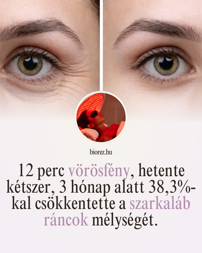 ✨ Összegyűjtöttünk nektek pár meglepő, tudományosan alátámasztott tényt a vörösfény-terápiáról ✨A szarkaláb ráncok, a bőr feszessége és a bőr tónusa nem véletlenül kerülnek fókuszba ezekben a vizsgálatokban a kutatások mögött valódi biológiai folyamatok állnak.Lapozz végig, és nézd meg, mit mond a tudomány.Ha pedig szeretnéd otthon is használni ezt a technológiát:biorez.hu